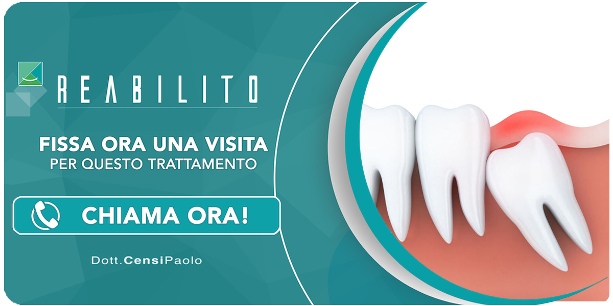 estrazione-denti-del-giudizio Anzola dell'Emilia (Bologna)