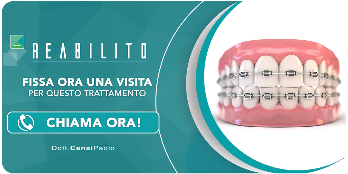 ortodonzia-fissa Anzola dell'Emilia (Bologna)